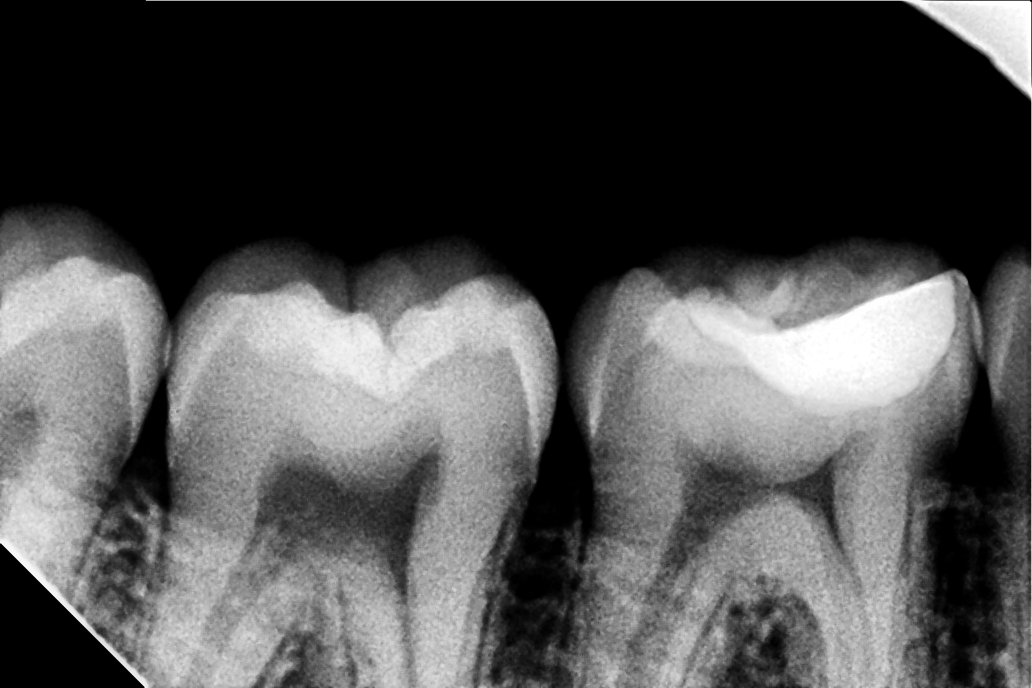After Treatment